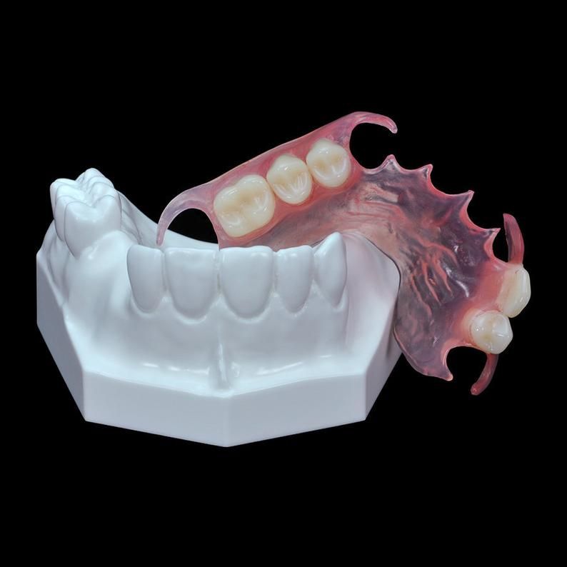 Prótese Parcial Removível